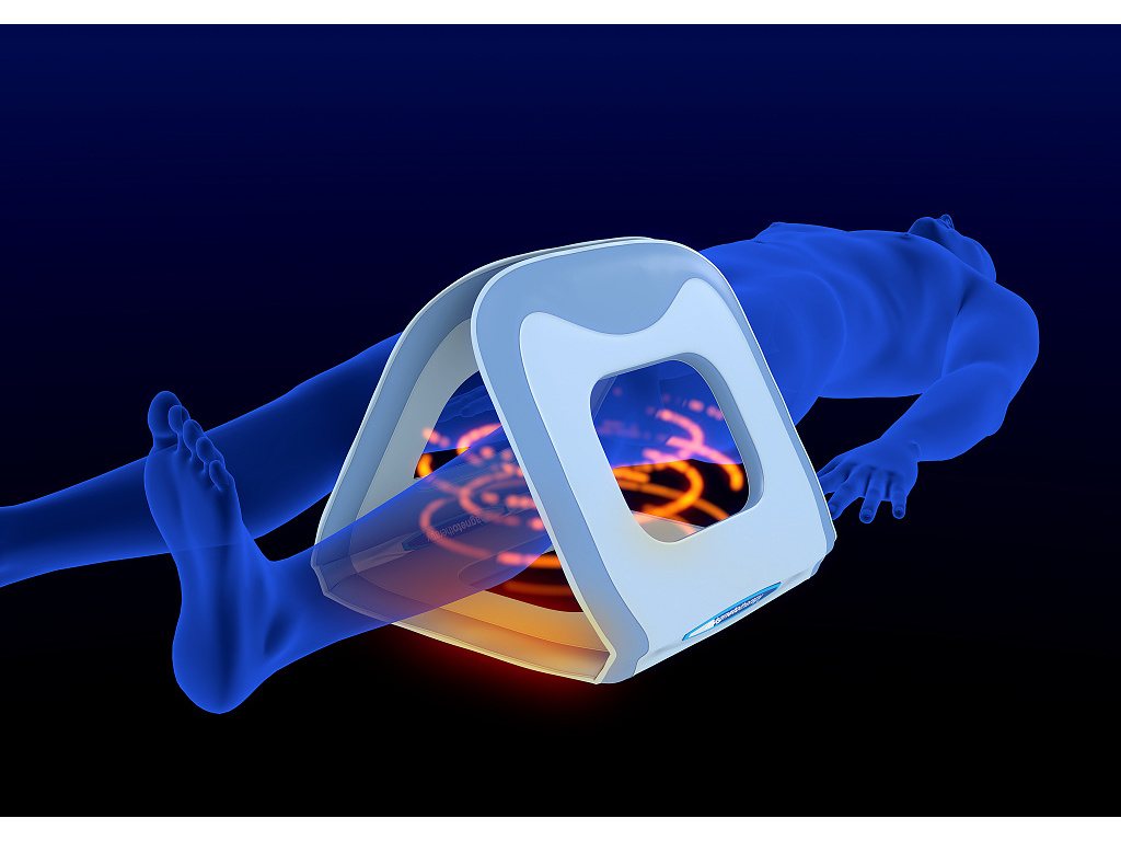 3D-Darstellung zeigt blauen AL115-3D-e COMBI Omega 3D Applikator, der während einer Magnetfeldtherapie über die Beine des Patienten positioniert ist.