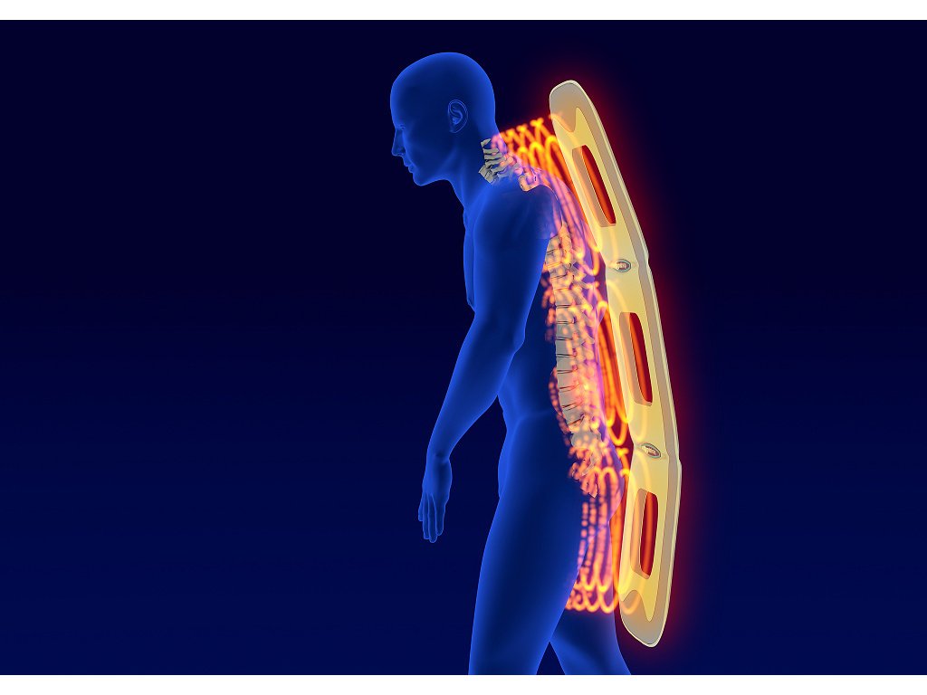 3D-Darstellung eines stehenden Patienten, der den AL115-3D-e COMBI Omega 3D Applikator am Rücken trägt, während Magnetfeldimpulse entlang der Wirbelsäule visualisiert werden.